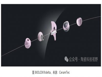 陶瓷材料在人工髖關節假體中的應用